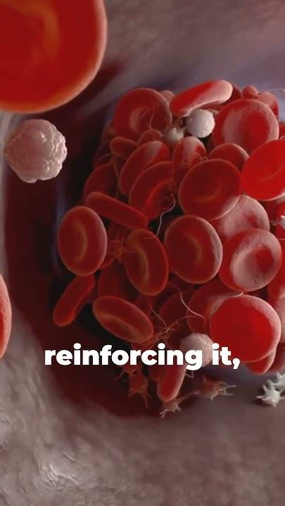 clots citi|Blood Clots Explained .